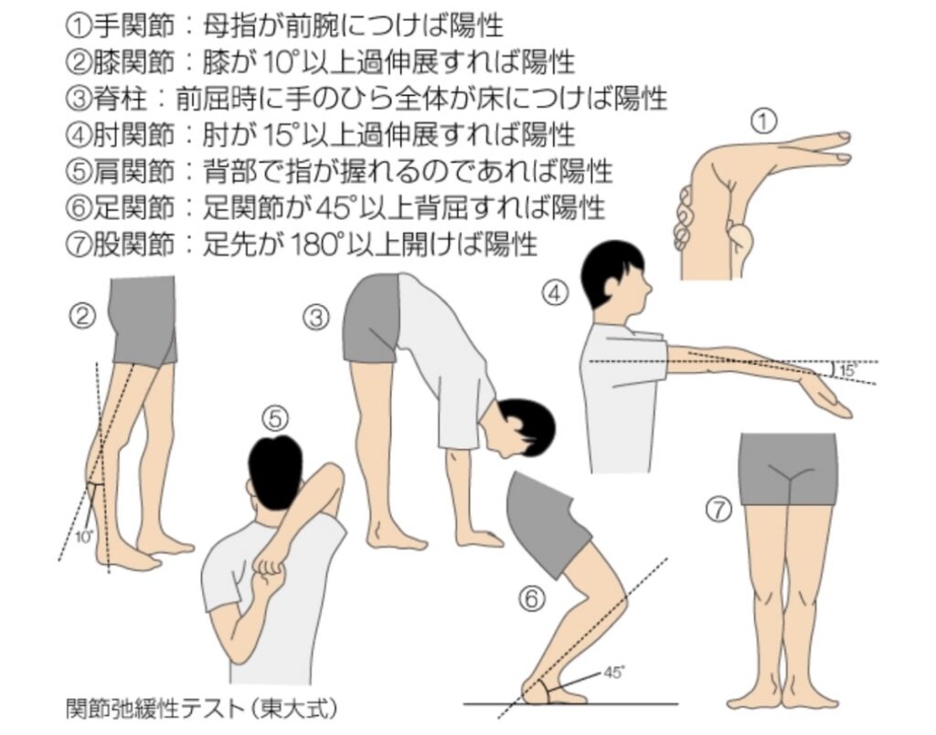 関節弛緩性テスト
